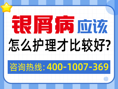 牛皮癣患者该如何预防